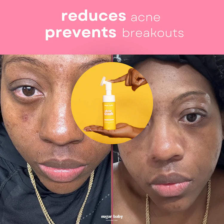 Zorla™ Turmeric Brightening Glow Face Wash