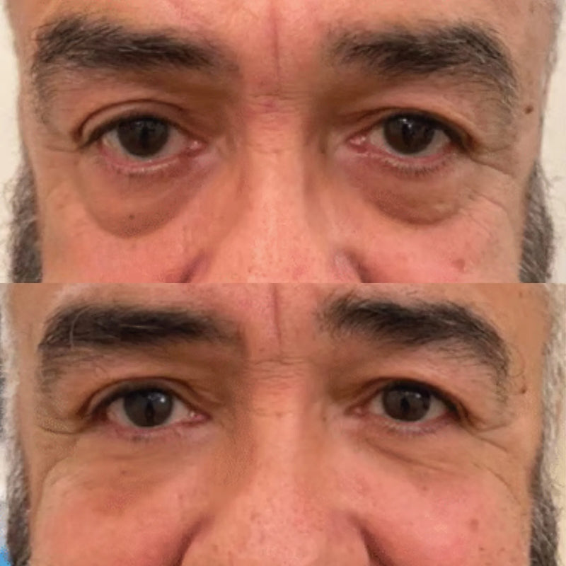 Customer before and after
