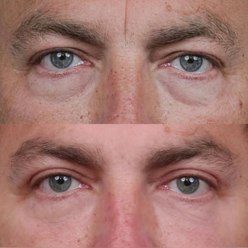 Customer before and after