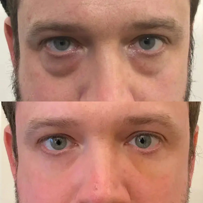 Customer before and after