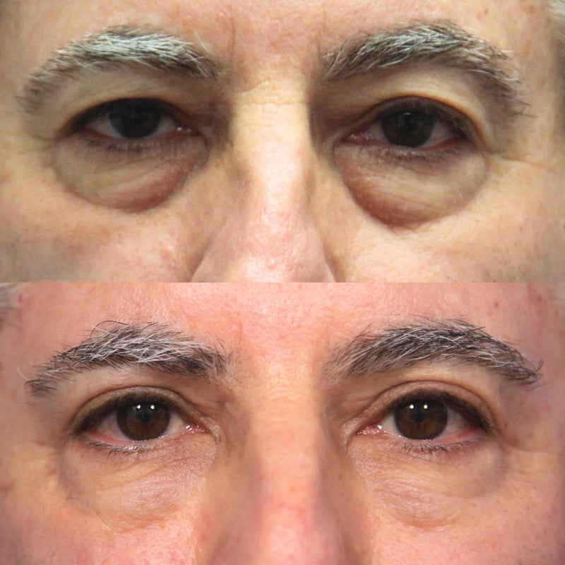 Customer before and after