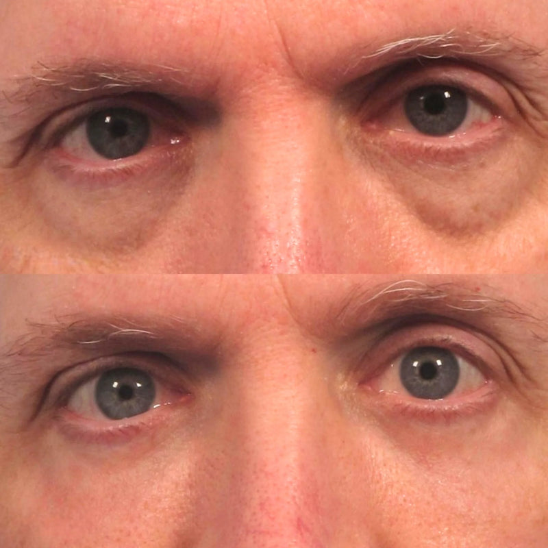 Customer before and after
