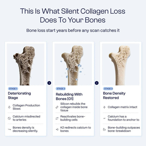 Bones [01] - The Clinical Protocol That Rebuilds Bone Density From The Inside Out