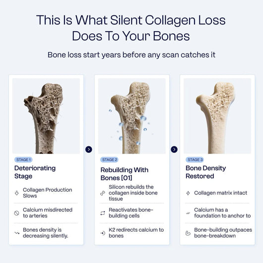Bones [01] - The Clinical Protocol That Rebuilds Bone Density From The Inside Out