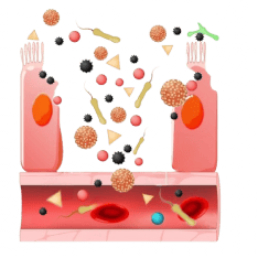 Damaged Gut