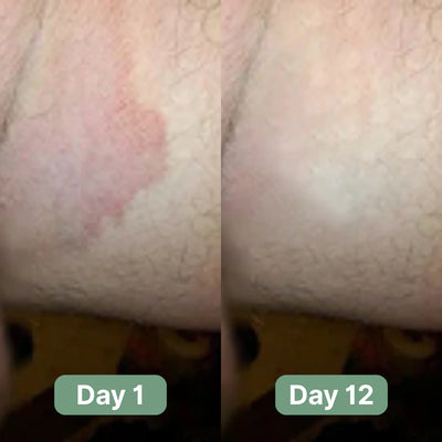 Veloma Antifungal Soap®