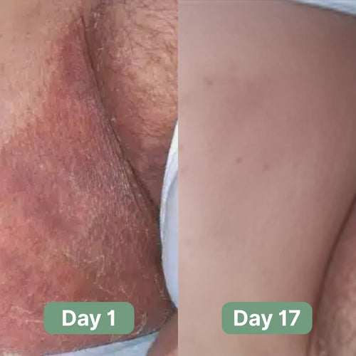Veloma Antifungal Soap®