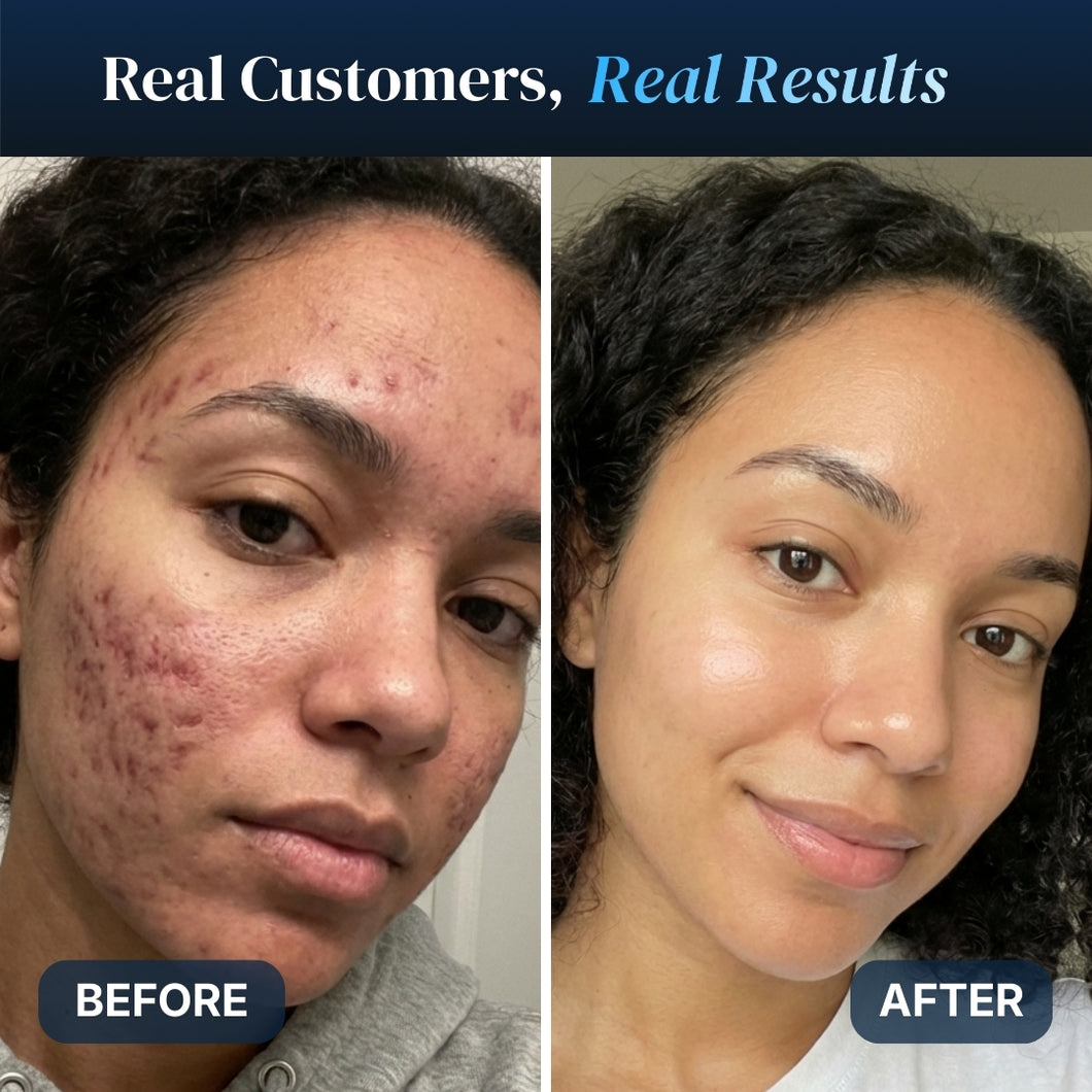 GHK-Cu Copper Peptides Serum