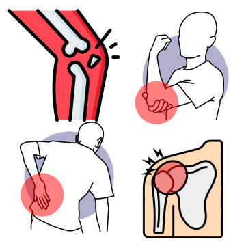 Unique properties reverse Joints & Muscle injuries
