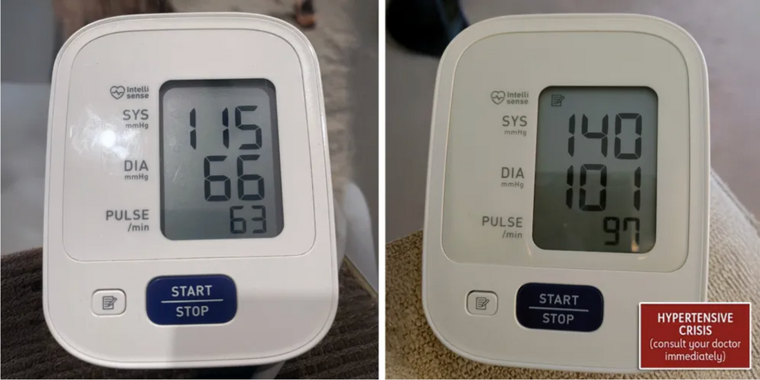 Blood pressure monitor before and after