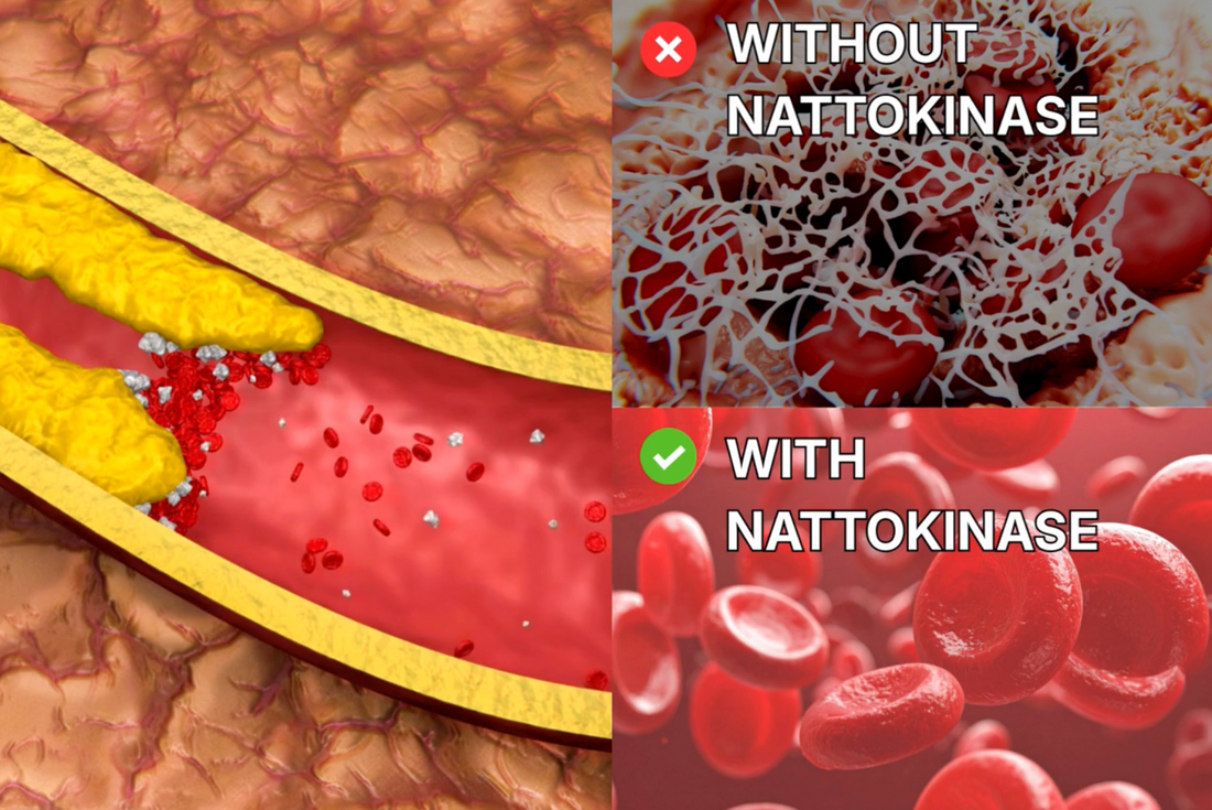 Without Nattokinase / With Nattokinase artery comparison