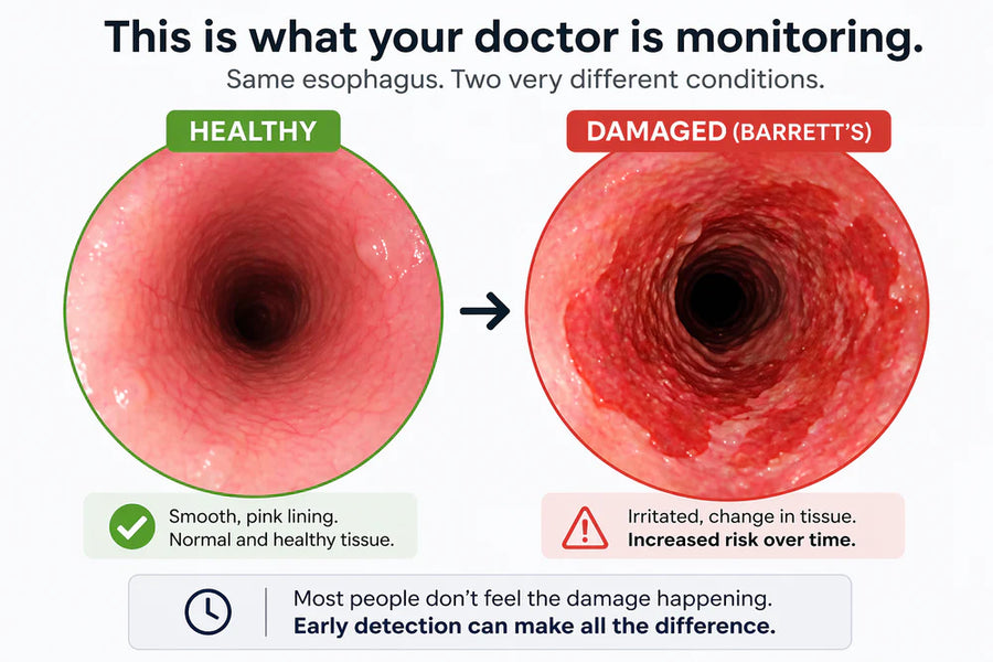 Healthy vs damaged Barrett's tissue