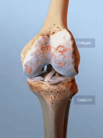 Knee collagen calcium image