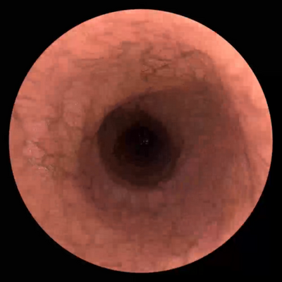 Esophagus tissue